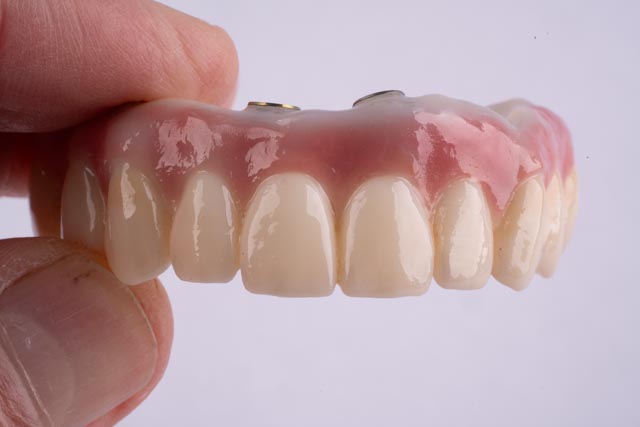 Dr. Mark Stankewitz holding a custom-layered All-on-4 zirconia prosthesis crafted in his in-house lab in Houston