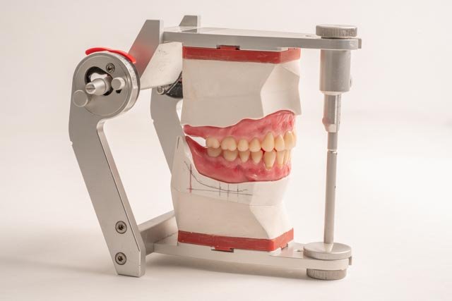 Handmade denture wax try-in on articulator by Dr. Mark Stankewitz – Houston board-certified prosthodontist